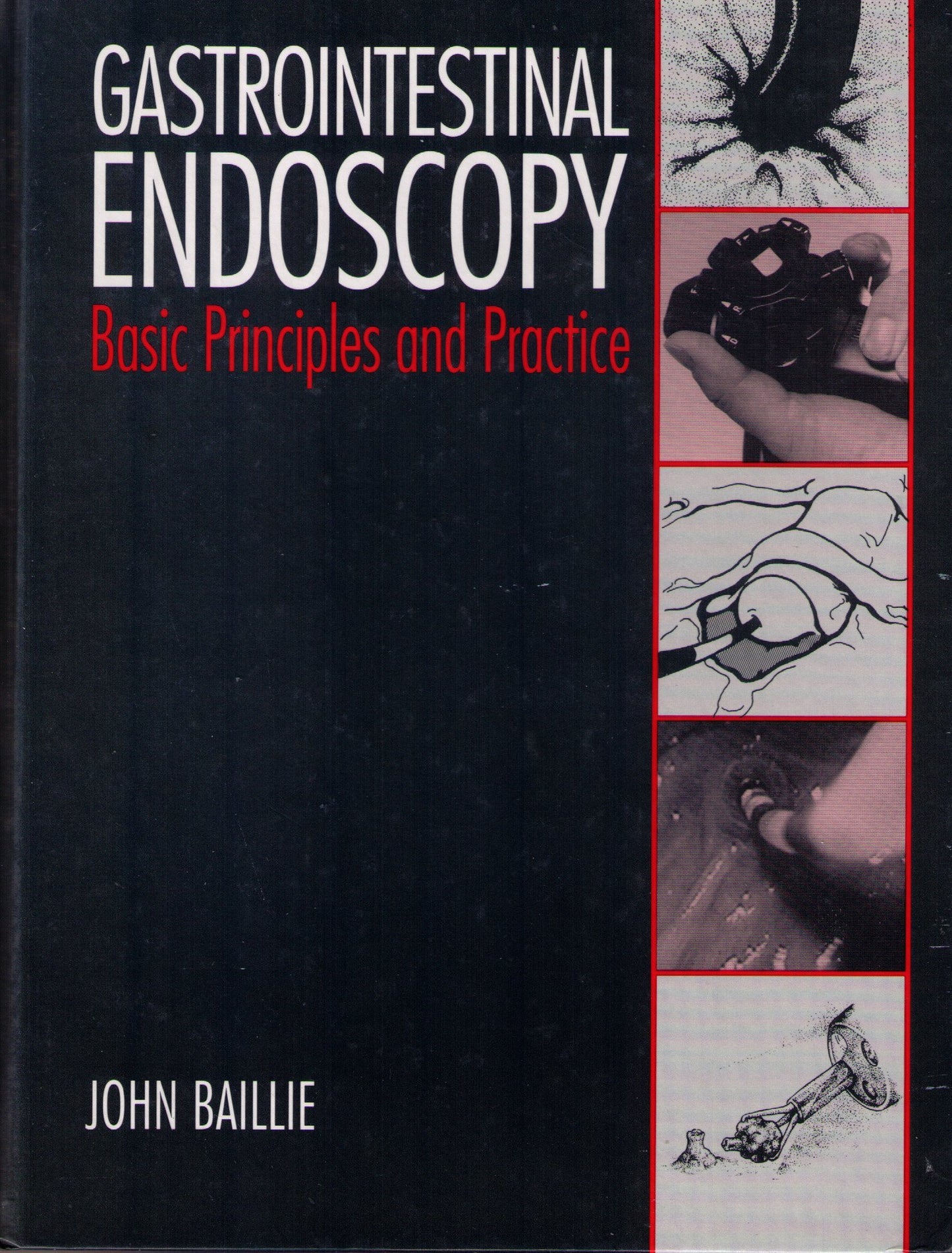 Gastrointestinal Endoscopy: Basic Principles and Practice