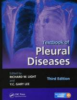 Textbook of Pleural Diseases