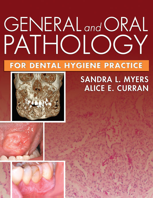 General and Oral Pathology for Dental Hygiene Practice