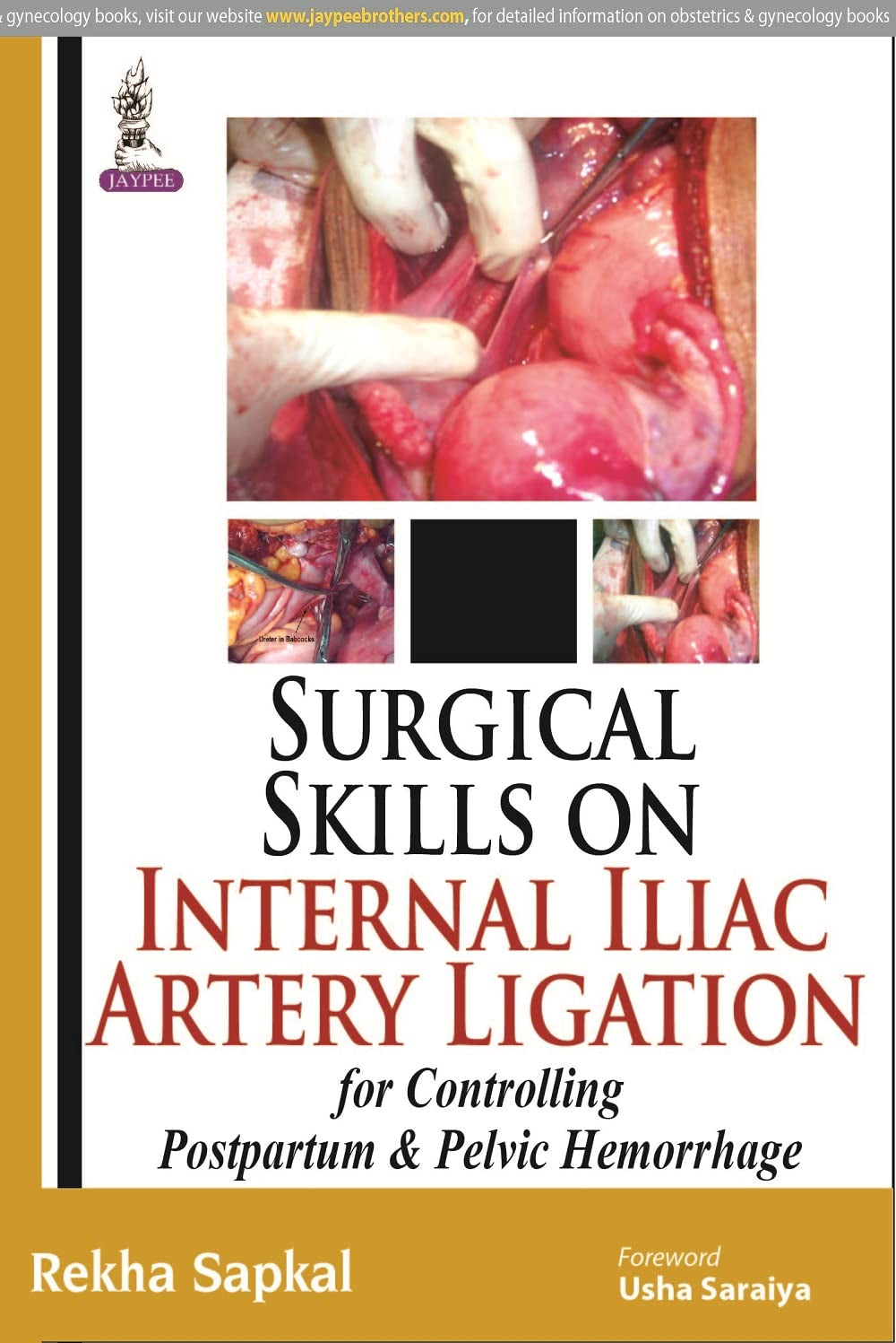 SURGICAL SKILLS ON INTERNAL ILIAC ARTERY LIGATION:FOR CONTROLLING POSTPARTUM & PELVIC HEMORRHAGE