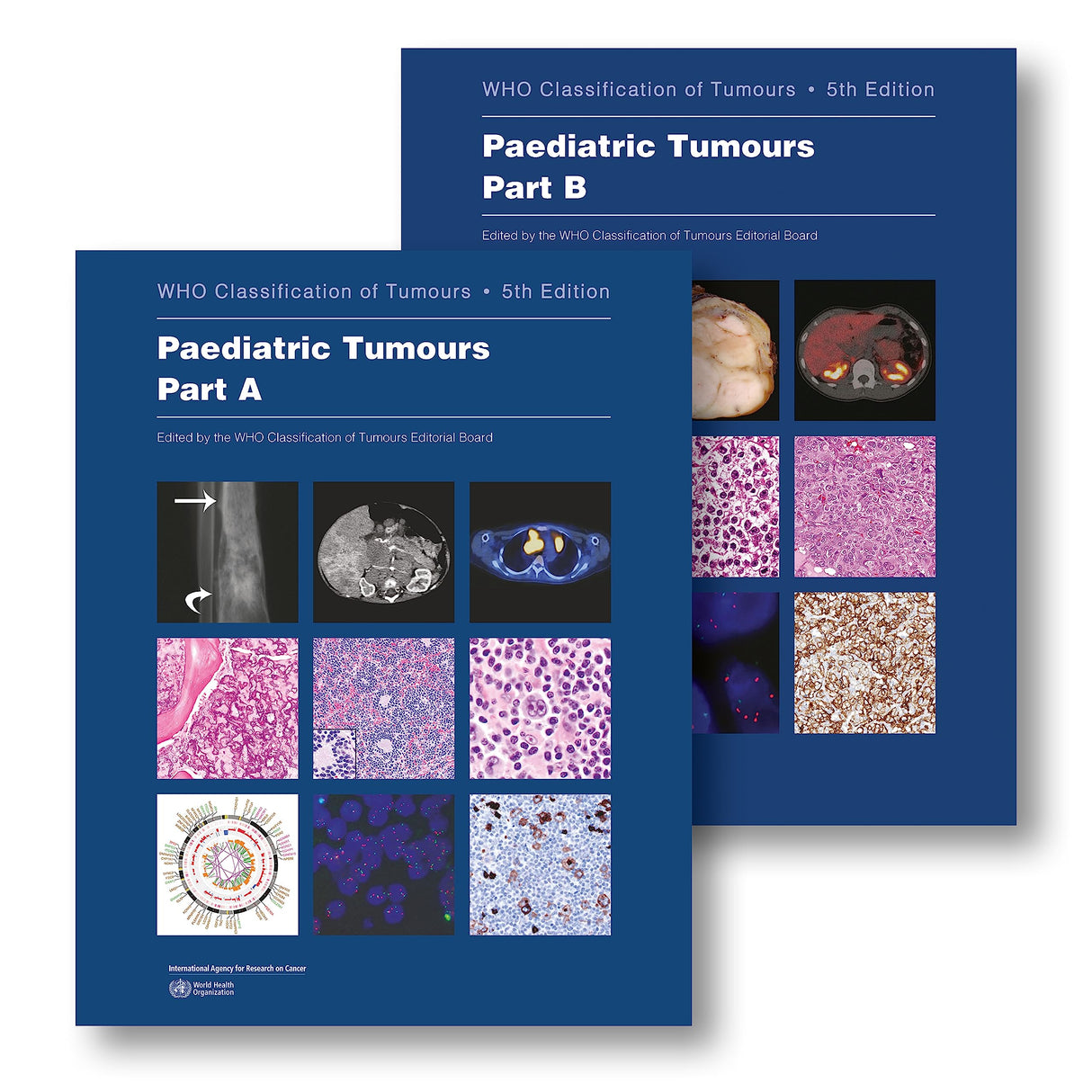 Paediatric Tumours