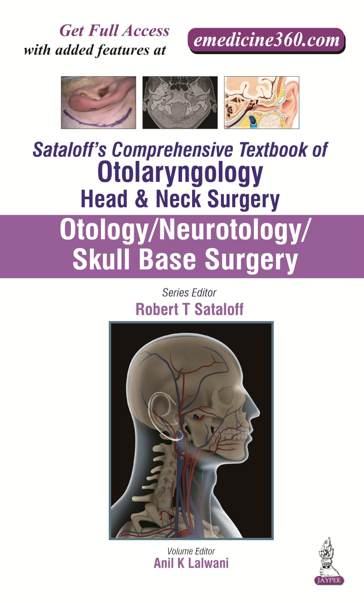 SATALOFF'S COMPREHENSIVE TB.OF OTOLARY.HEAD&NECK SURGERY OTOLOGY/NEUROTOLOGY/SKULL BASE SUR.VOL.1