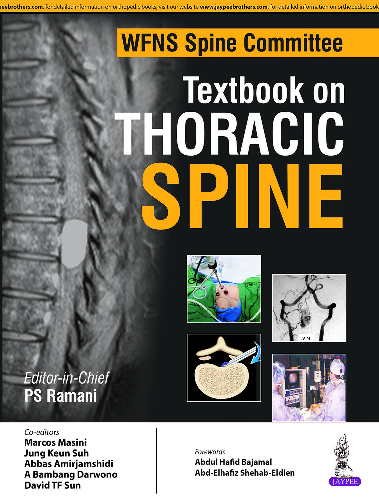 WFNS SPINE COMMITTEE TEXTBOOK ON THORACIC SPINE