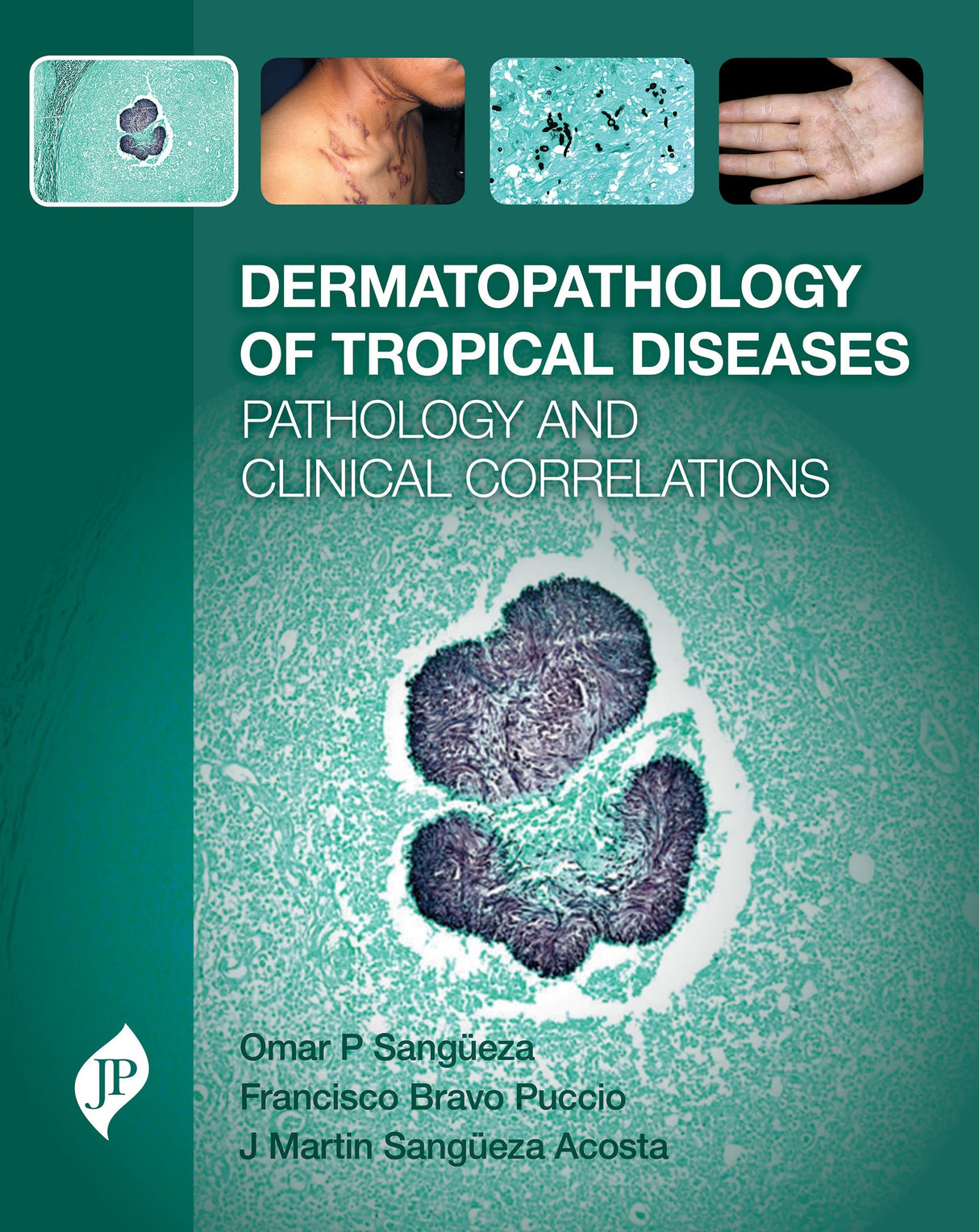 Dermatopathology of Tropical Diseases Pathology and Clinical Correlations
