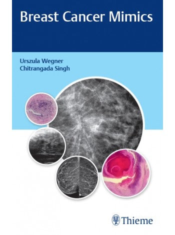 Breast Cancer Mimics 1st/2020 - Retail Maharaj