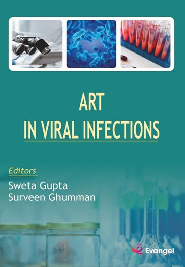 ART In Viral Infections 1st/2021