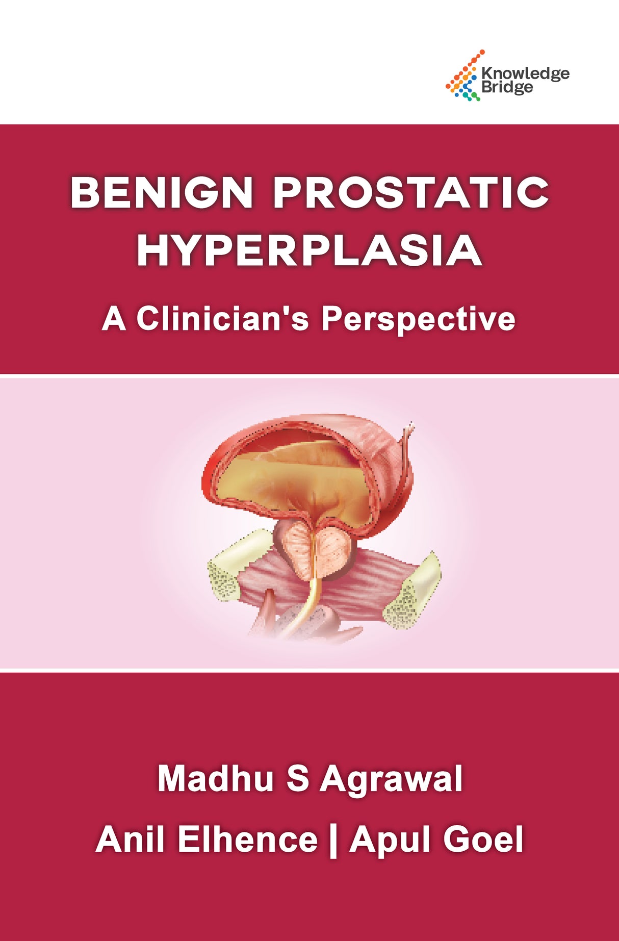 Benign Prostatic Hypertrophy A Clinician's Perspective 1st/2022