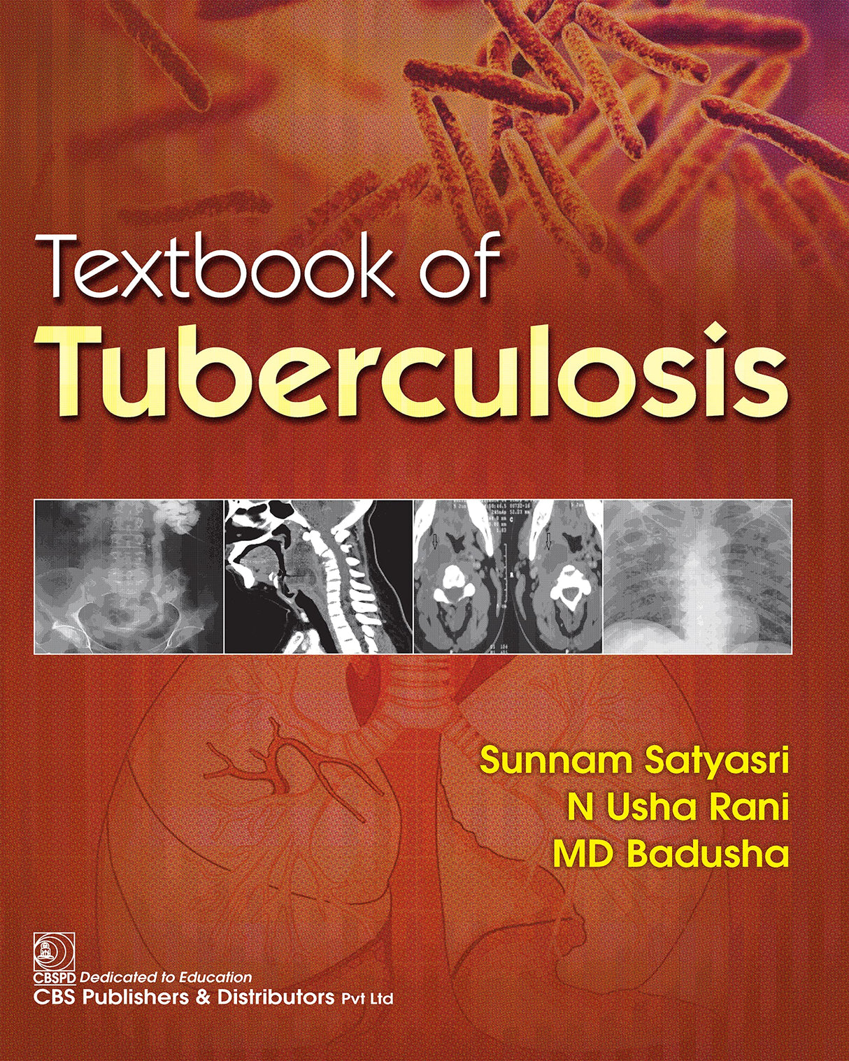 Textbook of Tuberculosis