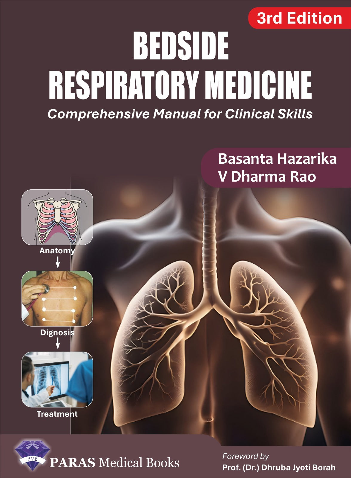Bedside Respiratory Medicine 3rd/2025