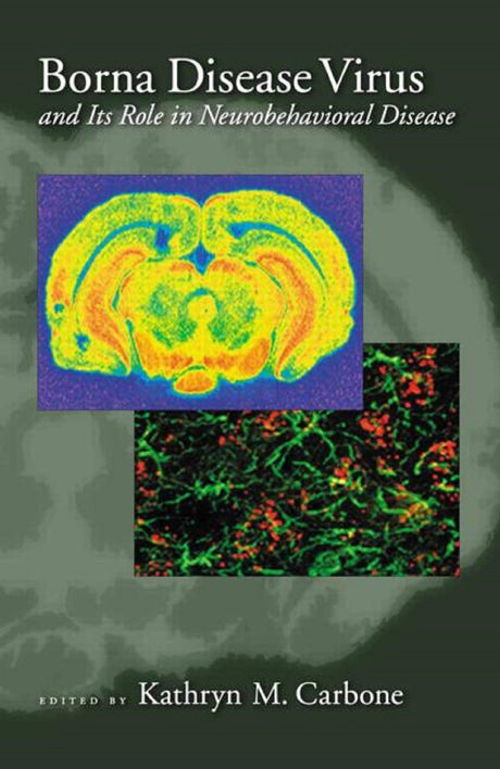 Borna Disease Virus: Role in Neurobehavioual Diseases - Retail Maharaj