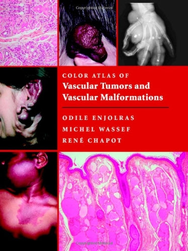 Color Atlas of Vascular Tumors and Vascular Malformations - Retail Maharaj