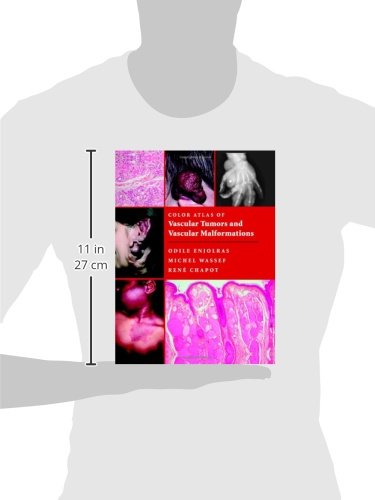 Color Atlas of Vascular Tumors and Vascular Malformations - Retail Maharaj