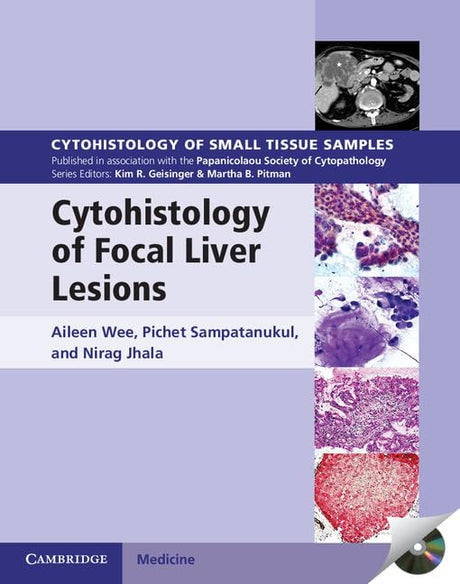CYTOHISTOLOGY OF FOCAL LIVER LESIONS (Cytohistology of Small Tissue Samples) - Retail Maharaj