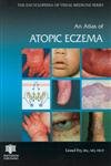 AN ATLAS OF ATOPIC ECZEMA - Retail Maharaj
