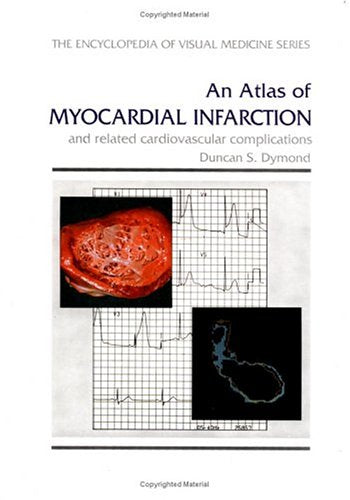 An Atlas of Myocardial Infarction and Related Cardiovascular Complications (Encyclopedia of Visual Medicine Series) - Retail Maharaj