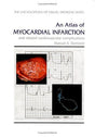 An Atlas of Myocardial Infarction and Related Cardiovascular Complications (Encyclopedia of Visual Medicine Series) - Retail Maharaj