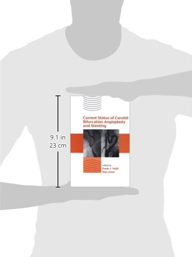 Current Status of Carotid Bifurcation Angioplasty and Stenting - Retail Maharaj