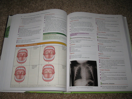 (OLD)PEDIATRIC NURSING THE CRITICAL COMPONENTS OF NURSING CARE PLUS CODE INSIDE - Retail Maharaj