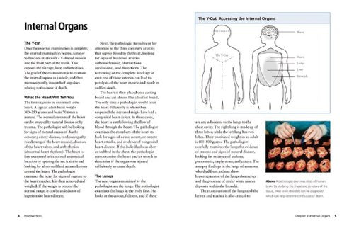 Postmortem: Establishing the Cause of Death - Retail Maharaj