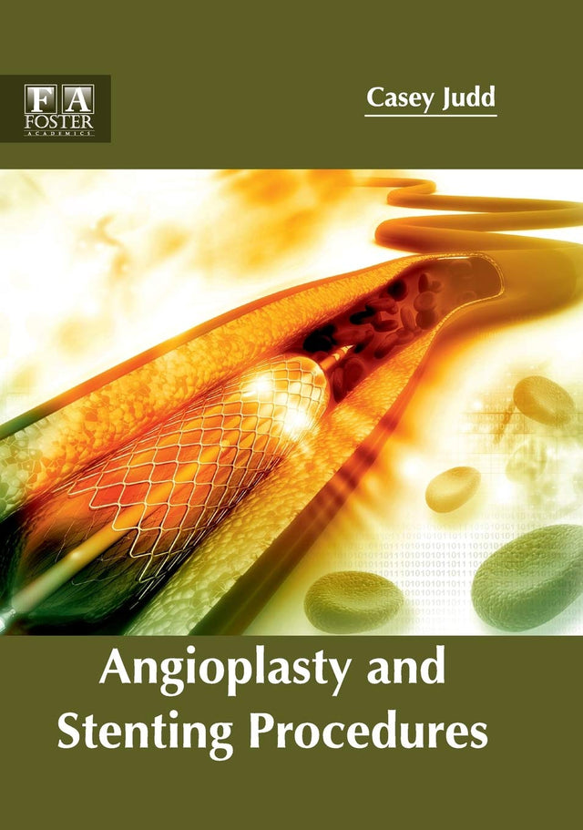 Angioplasty and Stenting Procedures - Retail Maharaj