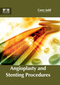 Angioplasty and Stenting Procedures - Retail Maharaj