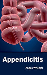 Appendicitis - Retail Maharaj
