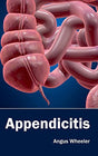 Appendicitis - Retail Maharaj