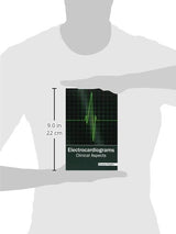 Electrocardiograms: Clinical Aspects - Retail Maharaj