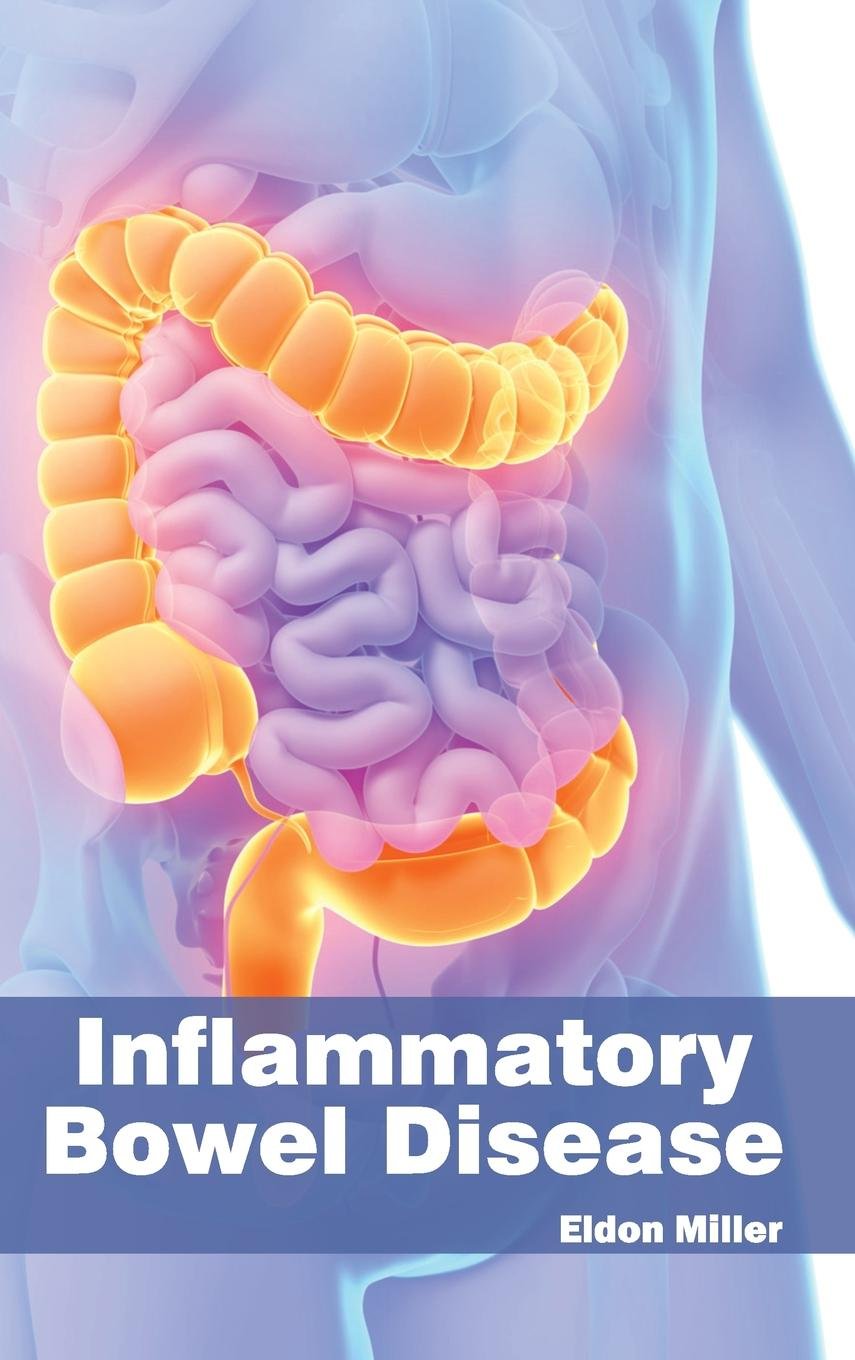 Inflammatory Bowel Disease - Retail Maharaj