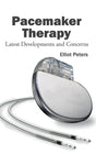Pacemaker Therapy: Latest Developments and Concerns - Retail Maharaj