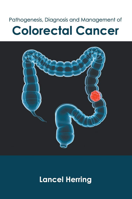 Pathogenesis, Diagnosis and Management of Colorectal Cancer - Retail Maharaj