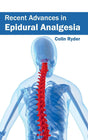 Recent Advances in Epidural Analgesia - Retail Maharaj