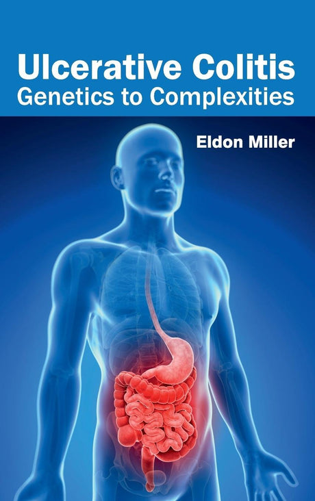 Ulcerative Colitis: Genetics to Complexities - Retail Maharaj