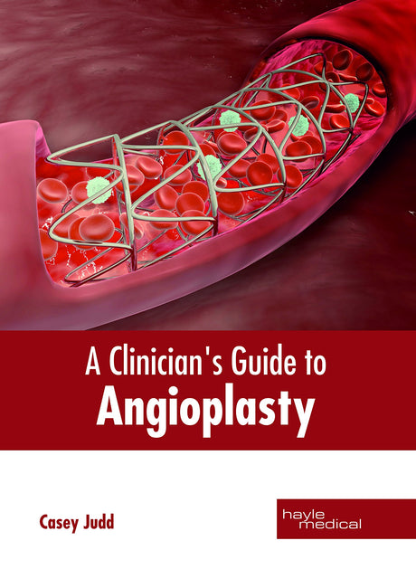 A Clinician's Guide to Angioplasty - Retail Maharaj