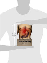 Current Approaches to Gastrostomy - Retail Maharaj