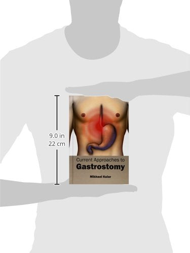 Current Approaches to Gastrostomy - Retail Maharaj