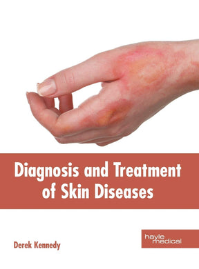 Diagnosis and Treatment of Skin Diseases - Retail Maharaj