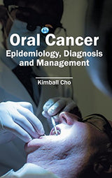 Oral Cancer: Epidemiology, Diagnosis and Management - Retail Maharaj