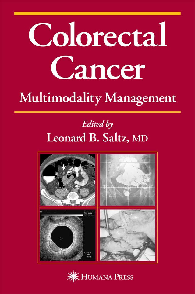 Colorectal Cancer: Multimodality Management (Current Clinical Oncology) - Retail Maharaj