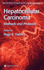 Hepatocellular Carcinoma: Methods and Protocols: 45 (Methods in Molecular Medicine) - Retail Maharaj