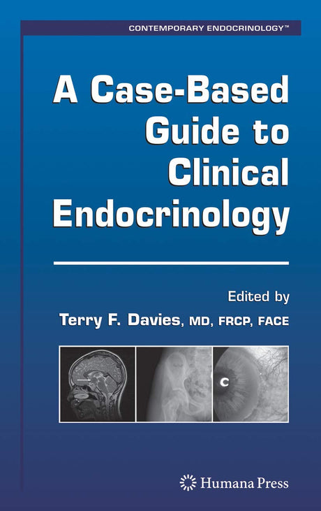 A Case-based Guide to Clinical Endocrinology (Contemporary Endocrinology) - Retail Maharaj