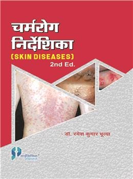 Skin Diseases 2nd Ed - Retail Maharaj