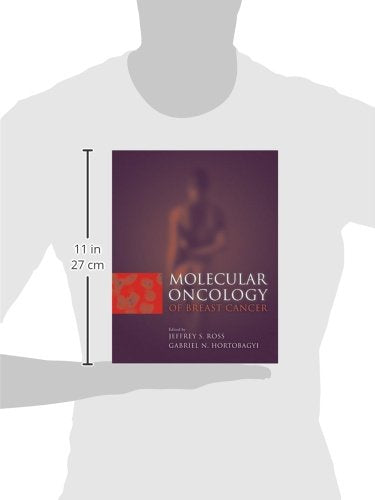 Molecular Oncology of Breast Cancer - Retail Maharaj