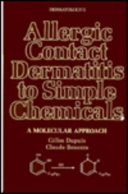 Allergic Contact Dermatitis to Simple Chemicals: A Molecular Approach (Dermatology) - Retail Maharaj