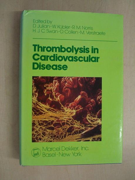 Thrombolysis in Cardiovascular Disease - Retail Maharaj