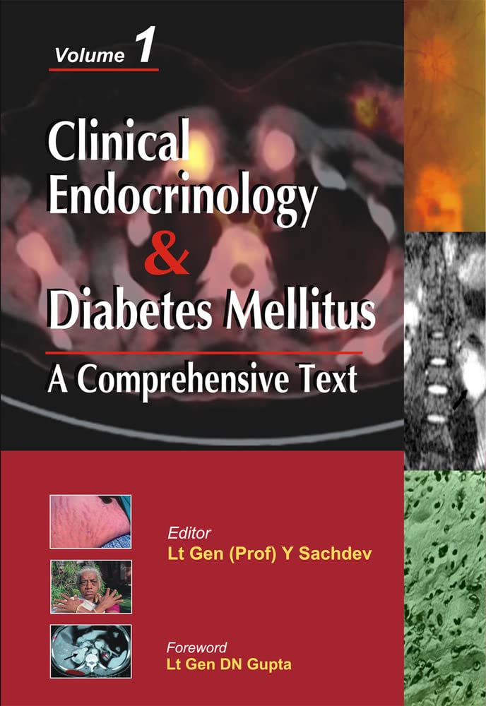 Clinical Endocrinology And Diabetes Mellitus:A Comprehensive Text- Vol.2 (MEDICAL/DENISTRY) - Retail Maharaj