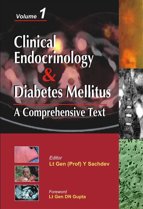 Clinical Endocrinology And Diabetes Mellitus:A Comprehensive Text- Vol.2 (MEDICAL/DENISTRY) - Retail Maharaj