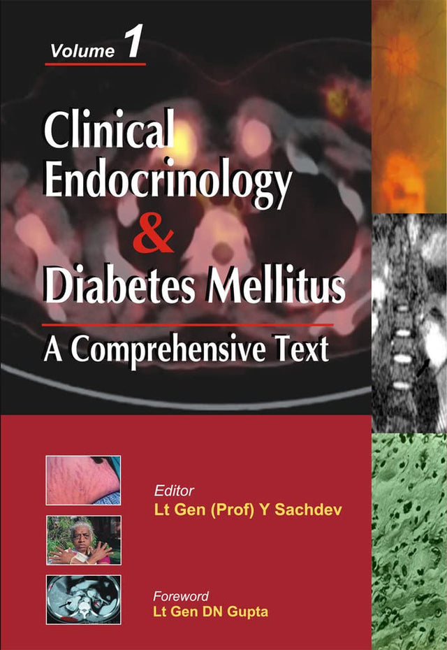 Clinical Endocrinology And Diabetes Mellitus:A Comprehensive Text- Vol.2 (MEDICAL/DENISTRY) - Retail Maharaj