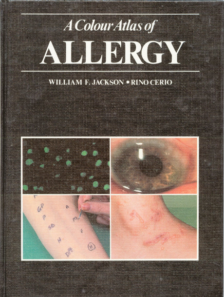 A Colour Atlas of Allergy - Retail Maharaj