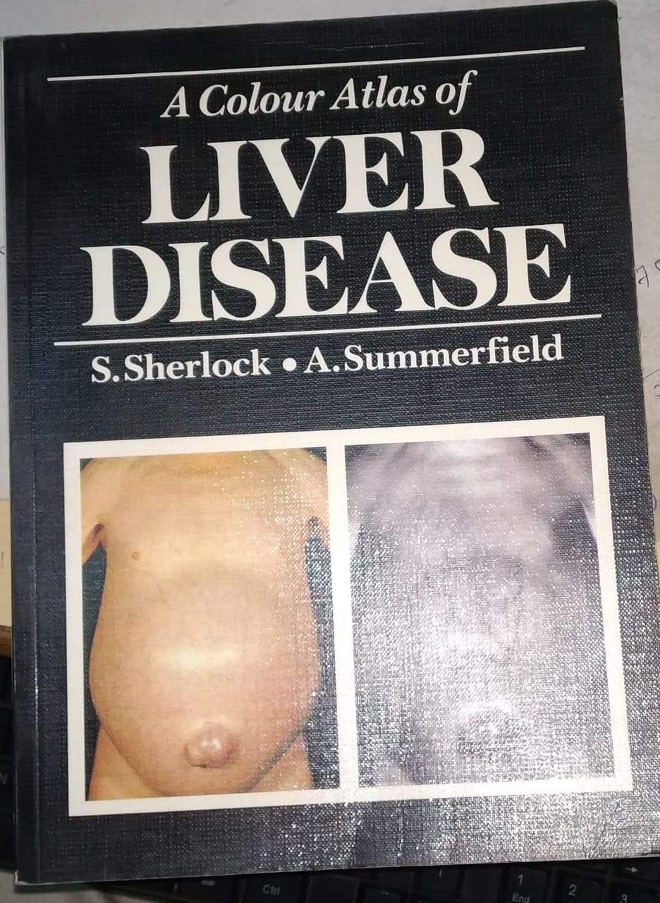 A Colour Atlas of Liver Disease - Retail Maharaj